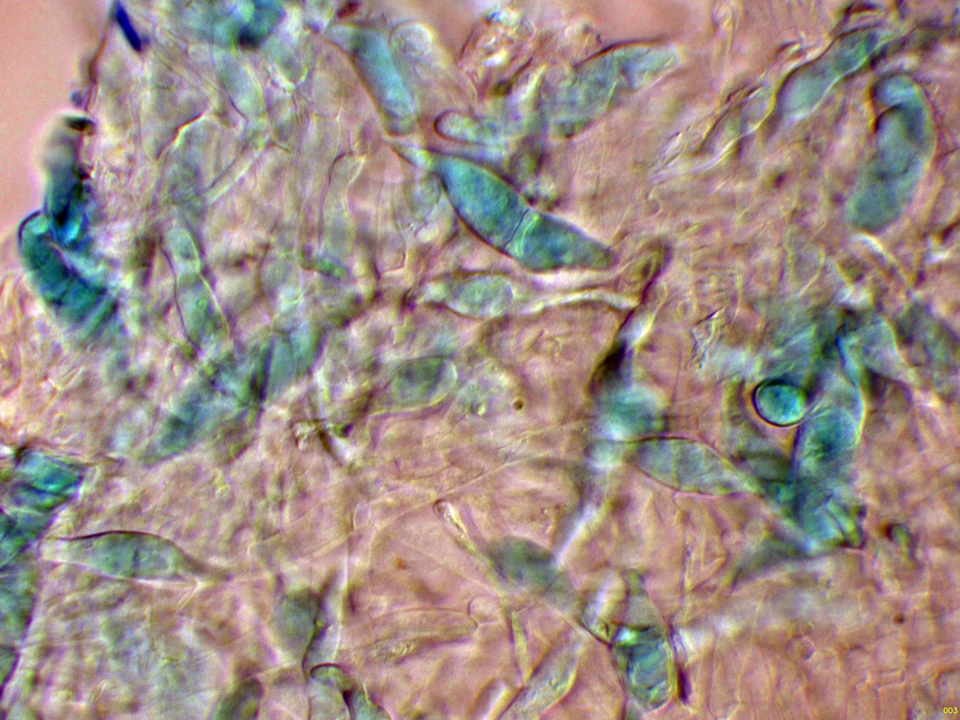Microscopía de Lactocollybia epia - 10 - Endogloeocistidios epicutis A. Cresilo-003